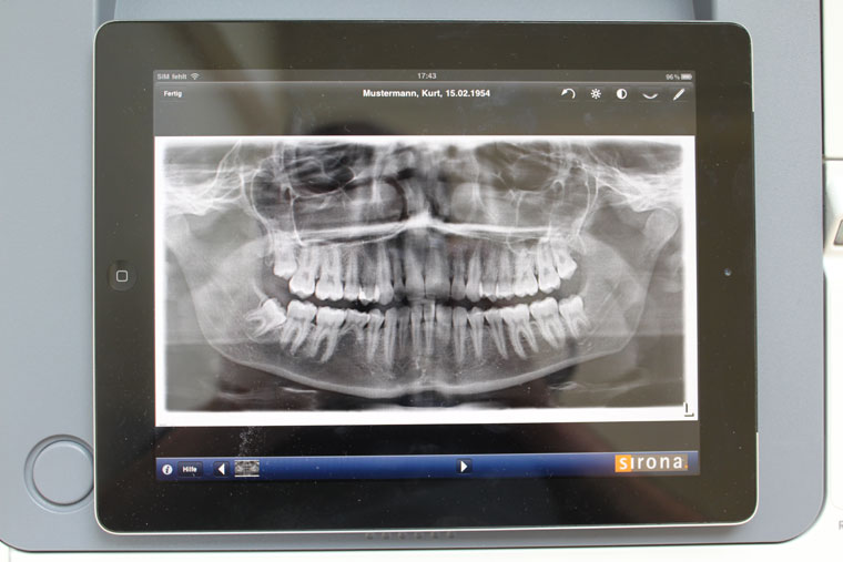Zahnarztpraxis Ostermann Röntgenbild auf dem IPad