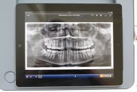 Röntgenbild auf dem iPad